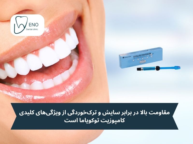 مزایای کامپوزیت توکویاما