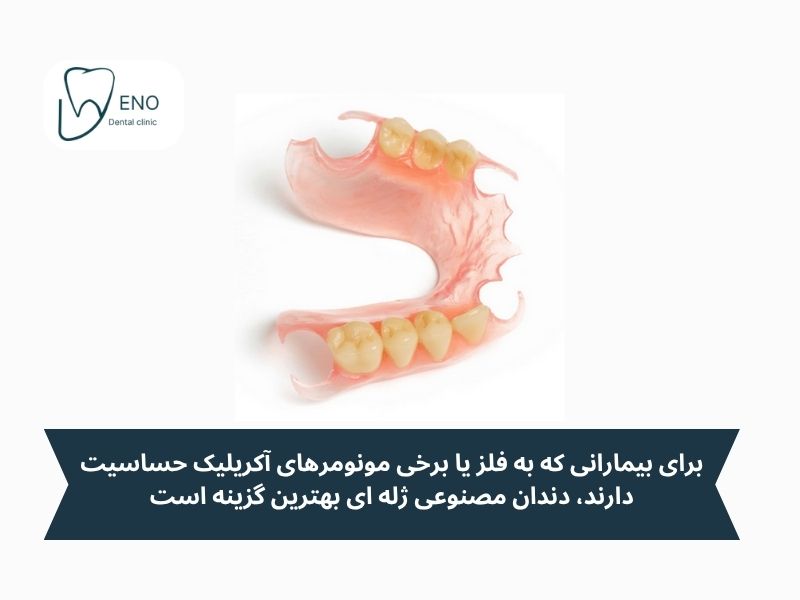 مزایای کلیدی دندان مصنوعی ژلهای