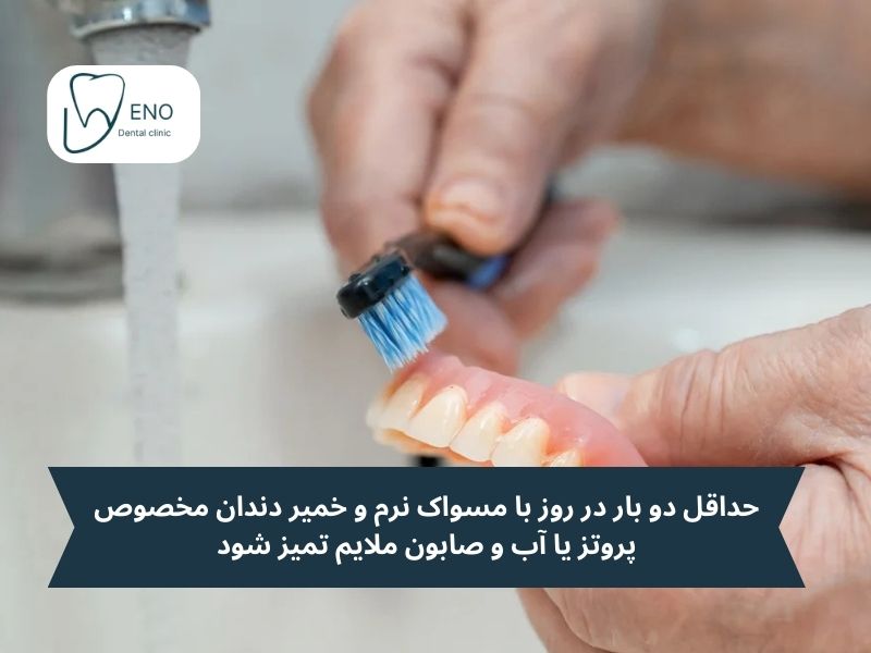 نگهداری پروتز دندان بدون کام