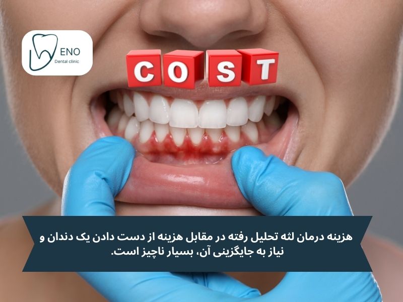 هزینه درمان لثه تحلیل رفته بدون جراحی؛ یک سرمایهگذاری هوشمندانه