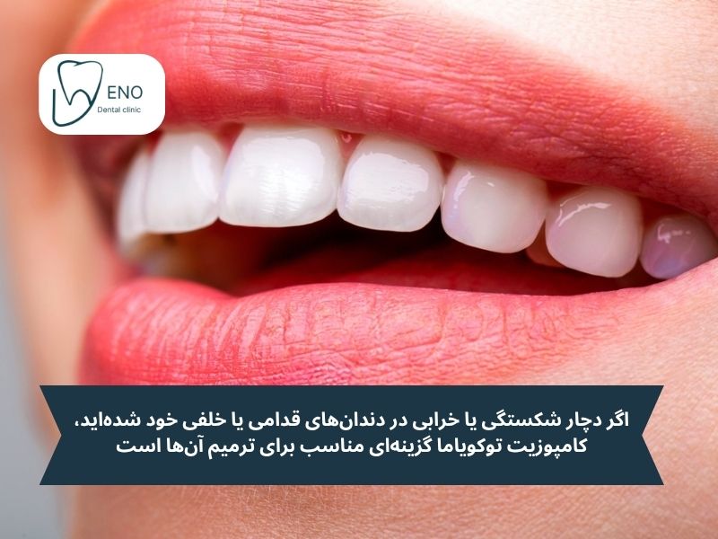 کاندیدای کامپوزیت توکویاما