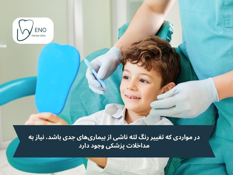 علت سیاه شدن لثه کودکان و نیاز به دندانپزشکی