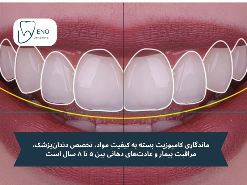 آیا کامپوزیت برای دندان های کج ماندگار است یا فقط راهی موقتی