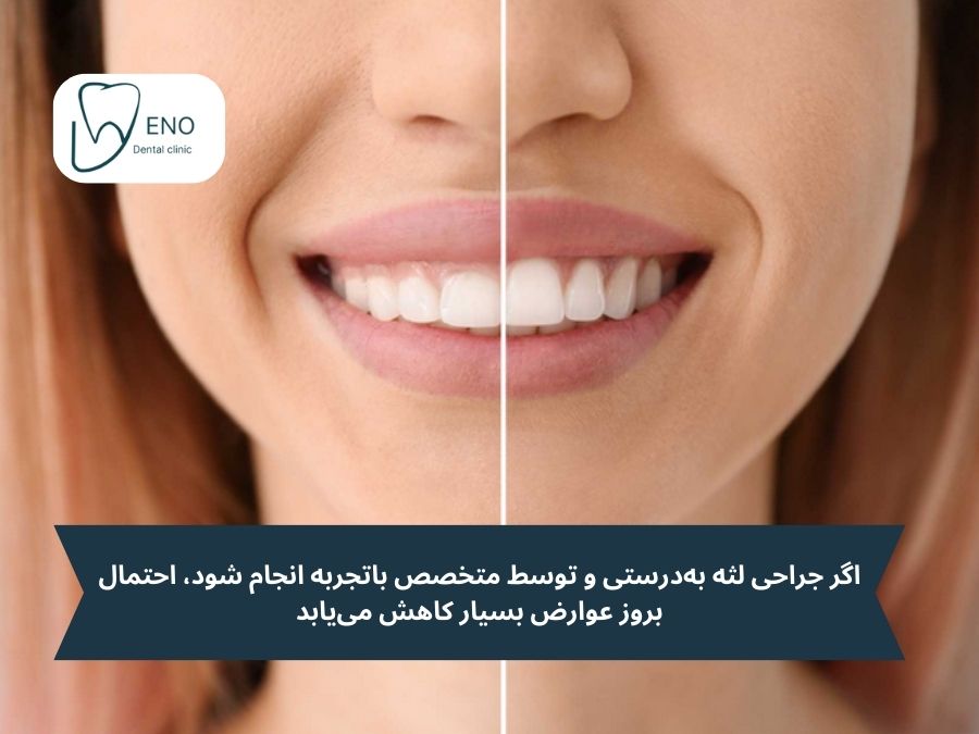 عوارض احتمالی جراحی لثه؛ آیا ارزش هزینه کردن دارد