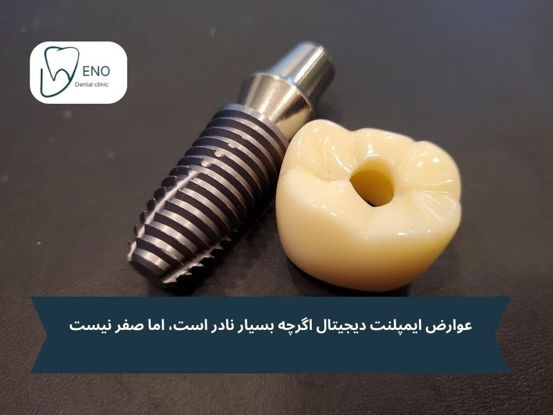 عوارض ایمپلنت دیجیتال