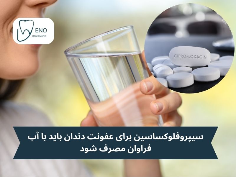 نکته مهم مصرف سیپروفلوکساسین برای عفونت دندان