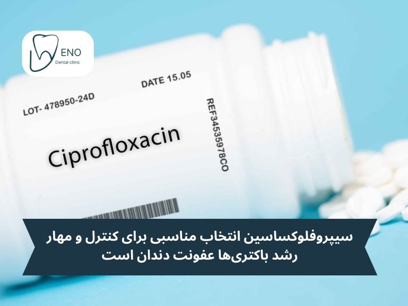 کاربرد اصلی سیپروفلوکساسین برای عفونت دندان