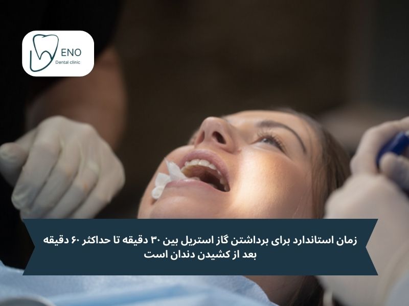 تا چند ساعت بعد کشیدن دندان گاز استریل را برداریم