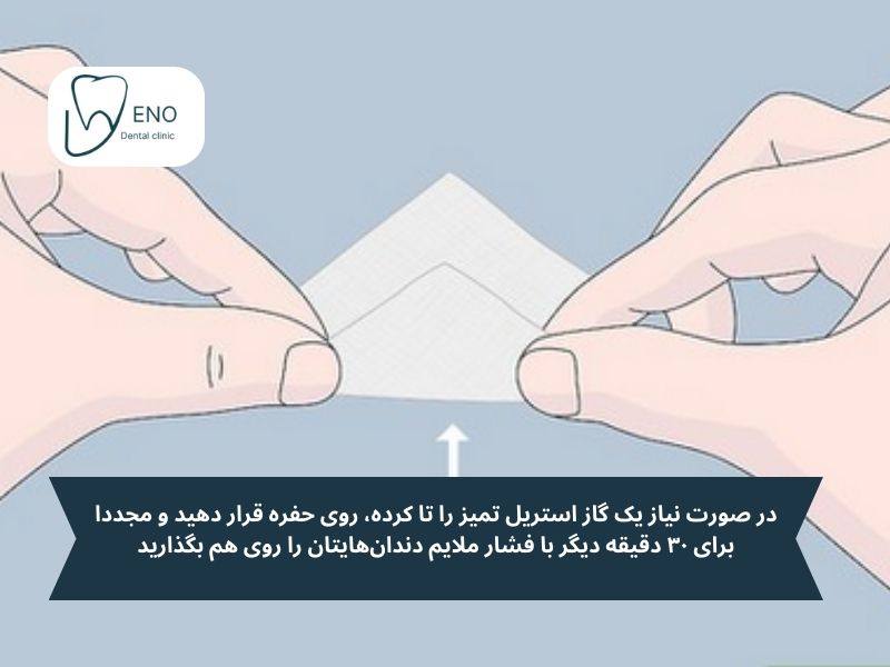 راهنمای گام به گام برداشتن و تعویض گاز استریل؛ یک فرآیند ساده اما دقیق