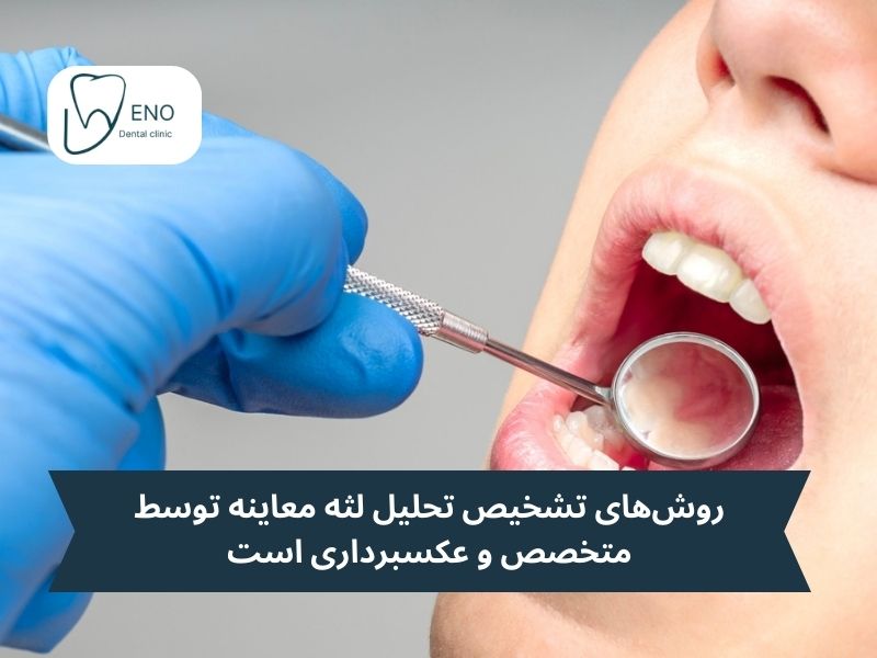 روشهای تشخیص تحلیل لثه چیست