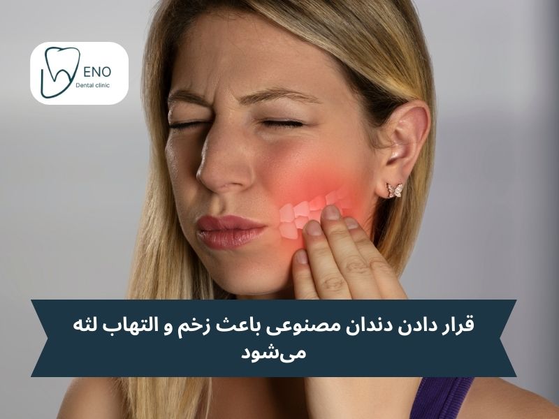 زخم لثه و مشکلات دندان مصنوعی