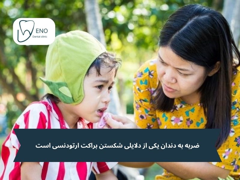 شکستن براکت و سیم ارتودنسی با ضربه