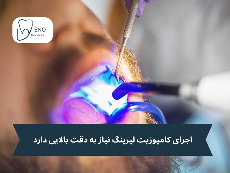 اجرای کامپوزیت لیرینگ