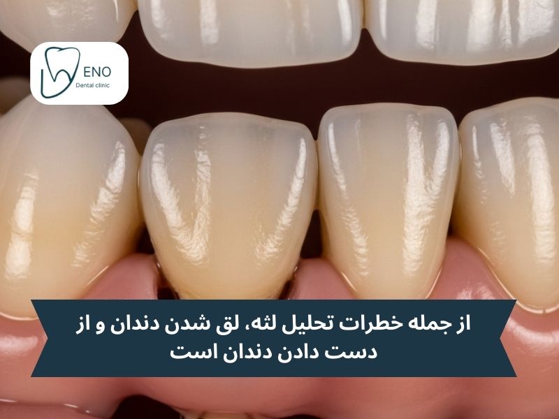خطرات تحلیل لثه چیست