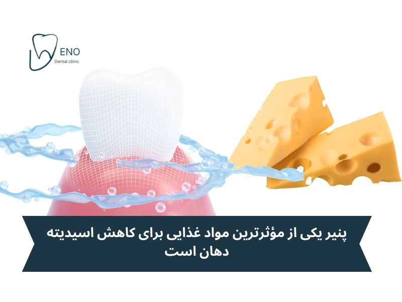 خواص لبنیات برای دندان کاهش اسیدیته دهان