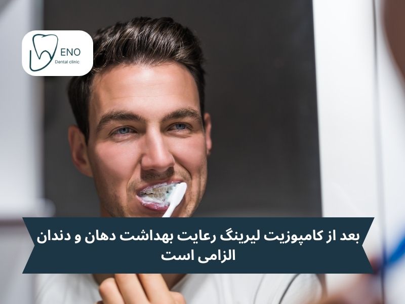 بعد از کامپوزیت لیرینگ رعایت بهداشت الزامی است