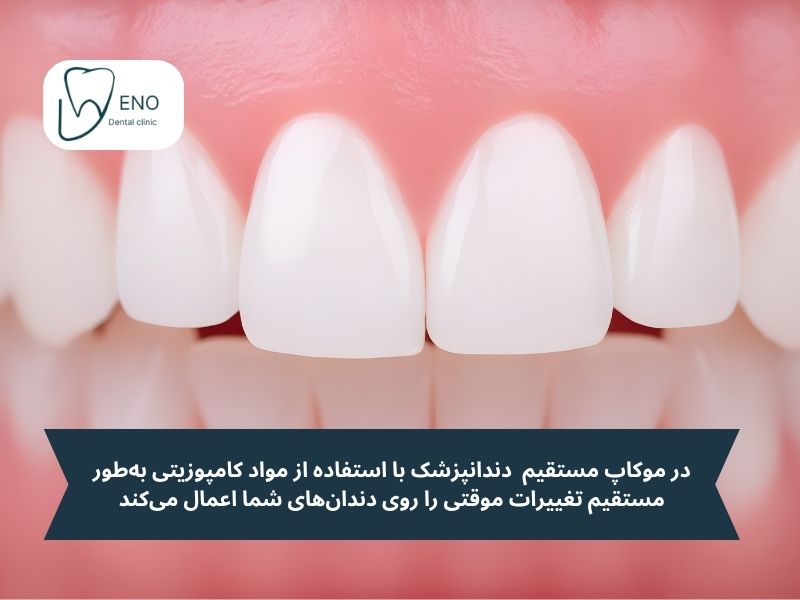 انواع موکاپ دندان؛ روشهای اجرای مدل آزمایشی لبخند
