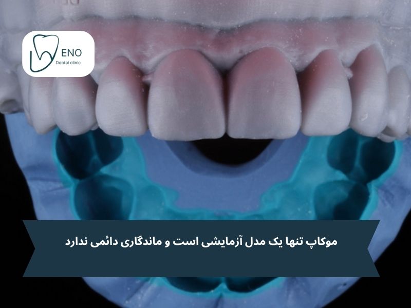 معایب و محدودیتهای موکاپ دندان