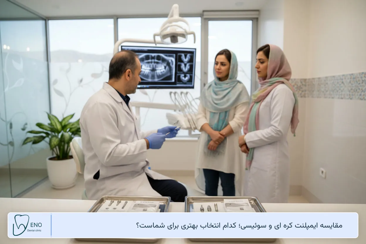 مقایسه ایمپلنت کره ای و سوئیسی