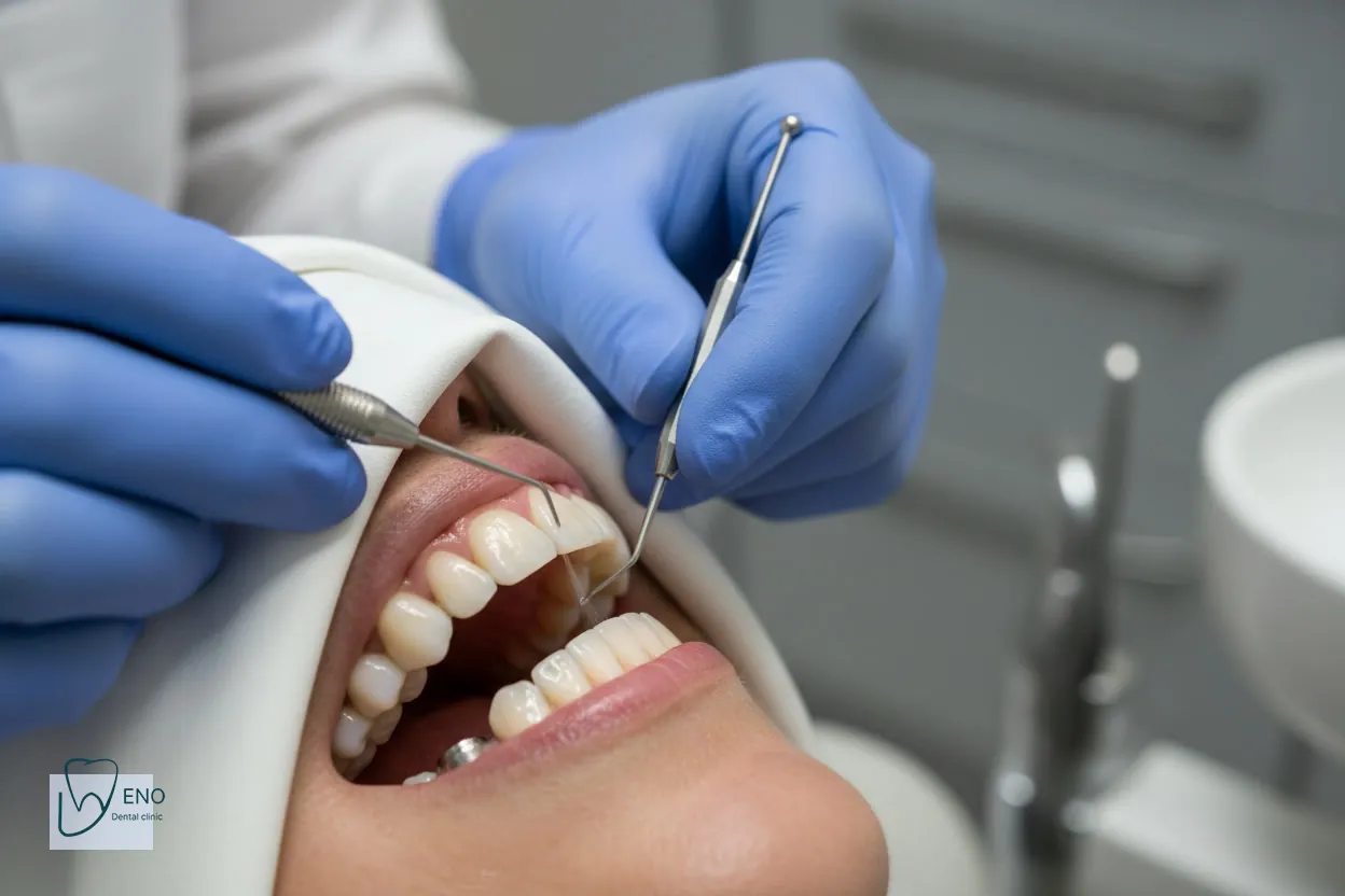 مراحل بررسی و درمان شل شدن روکش یا پیچ ایمپلنت در مطب