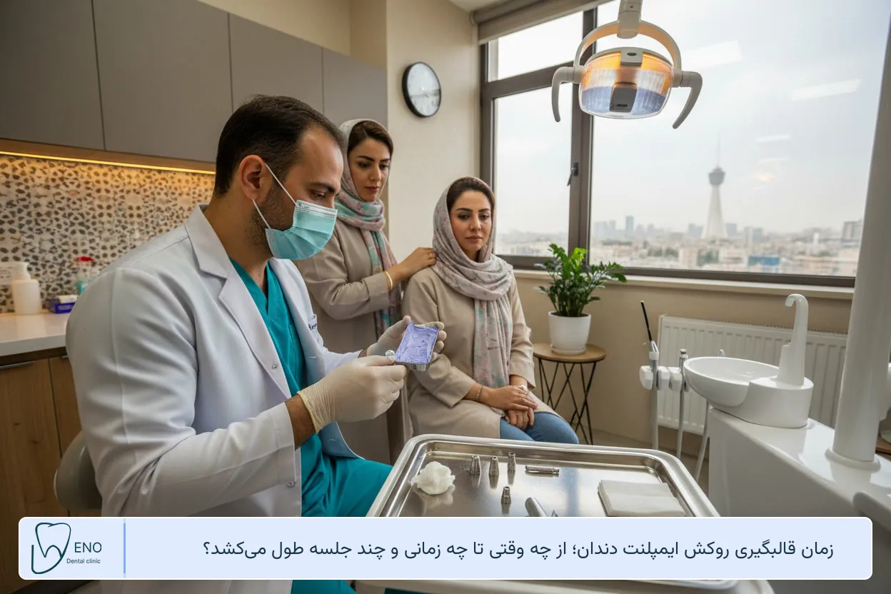 زمان قالبگیری روکش ایمپلنت دندان