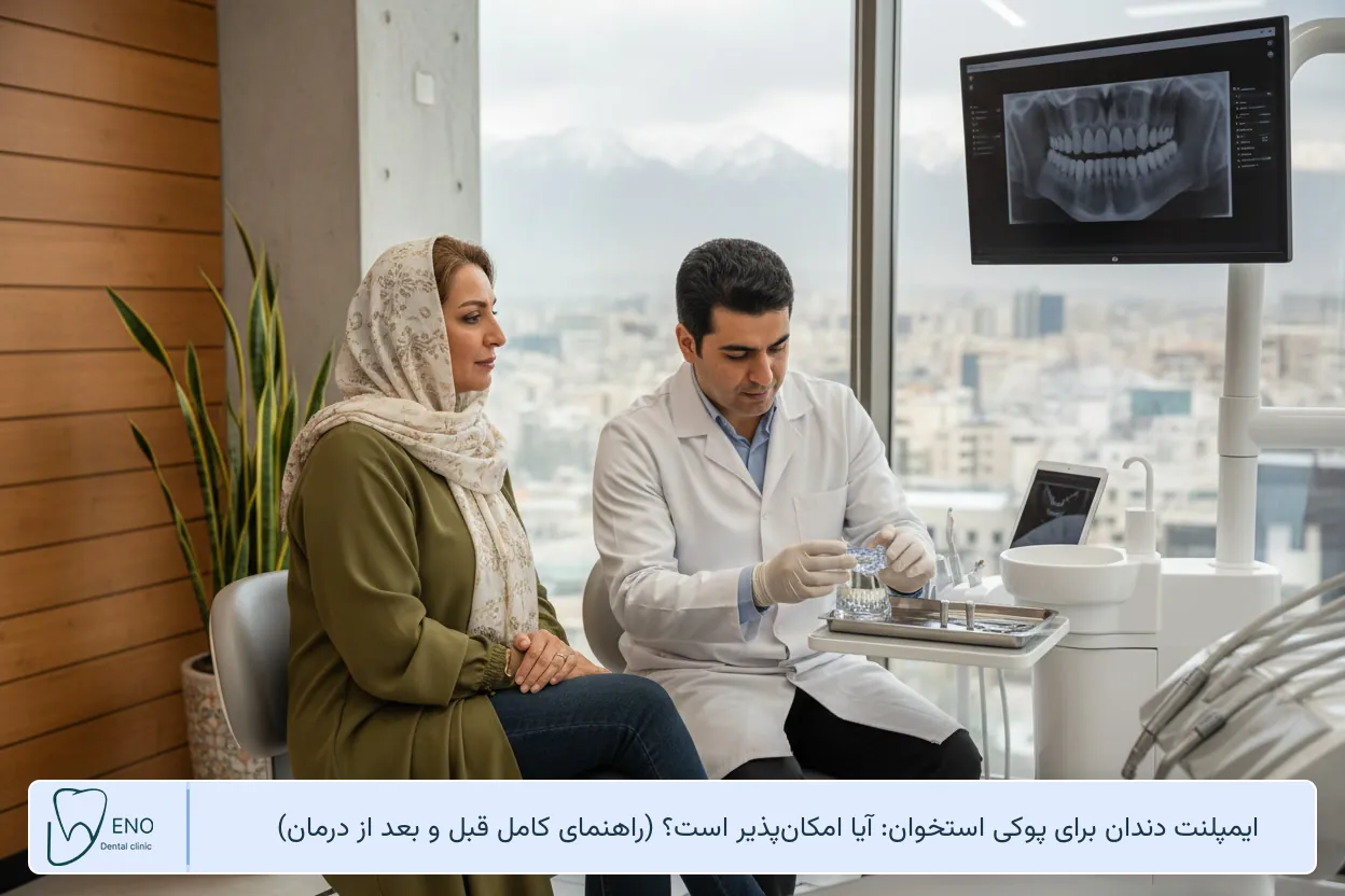 ایمپلنت دندان برای پوکی استخوان