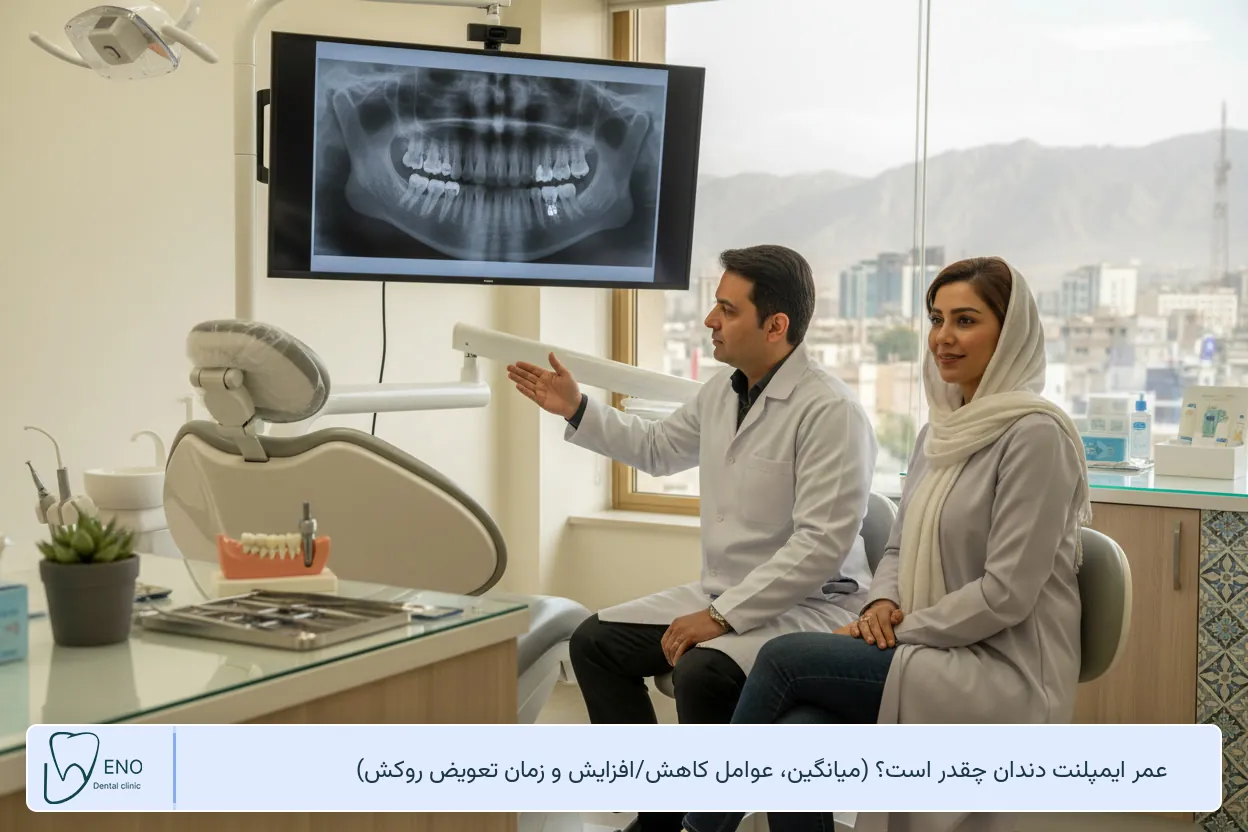 عمر ایمپلنت دندان چقدر است