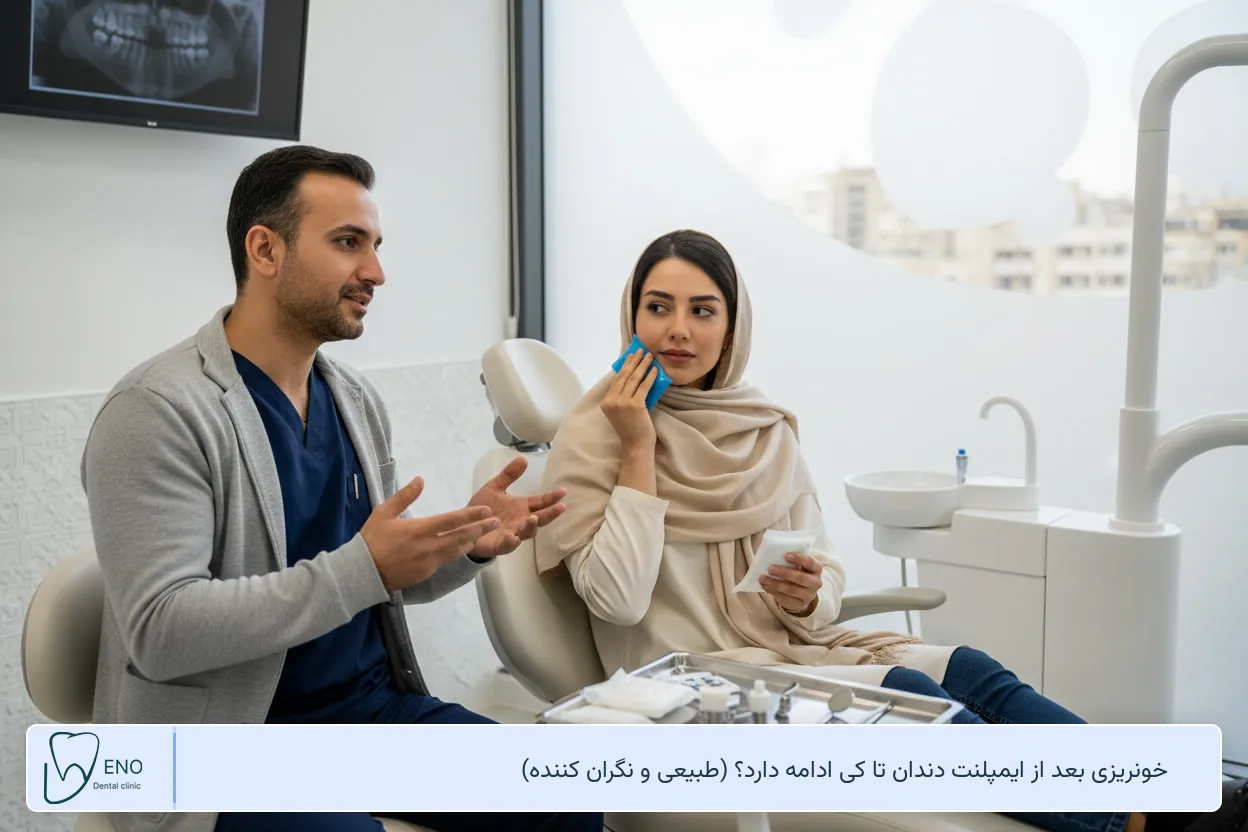 خونریزی بعد از ایمپلنت دندان تا کی ادامه دارد