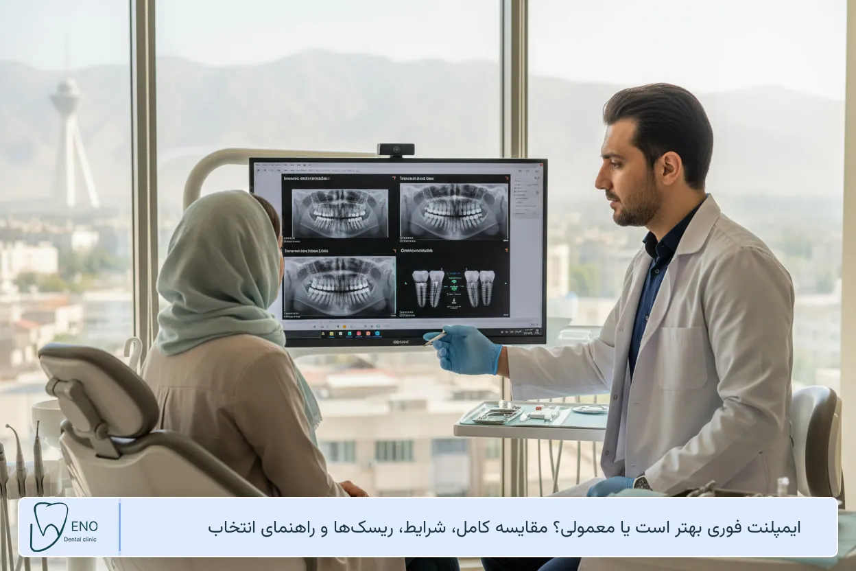 ایمپلنت فوری بهتر است یا معمولی