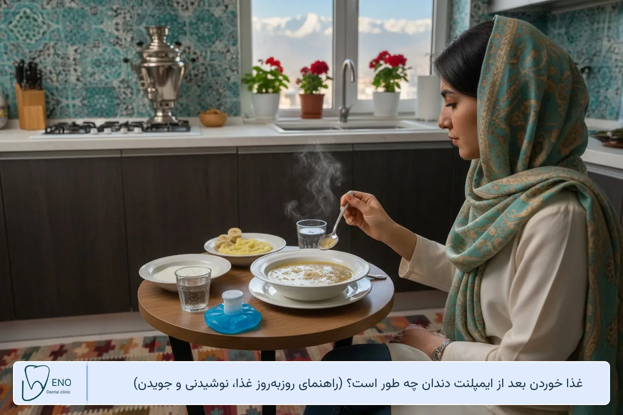 غذا خوردن بعد از ایمپلنت دندان چه طور است
