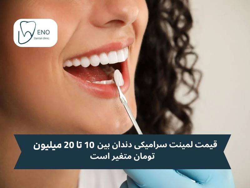 قیمت لمینیت دندان